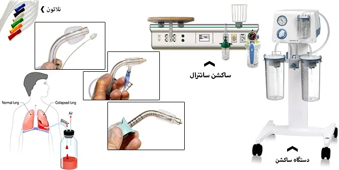 تعمیرات دستگاه ساکشن در اهواز