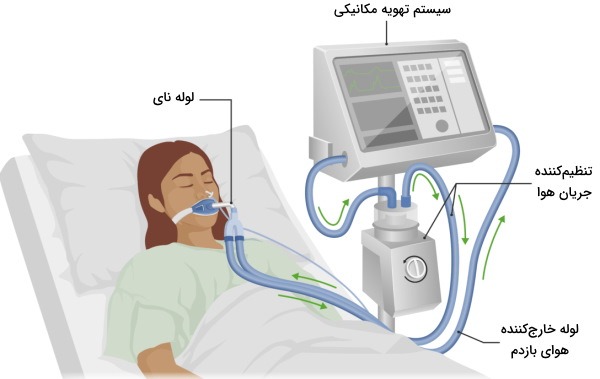 تعمیرات ونتیلاتور در اهواز