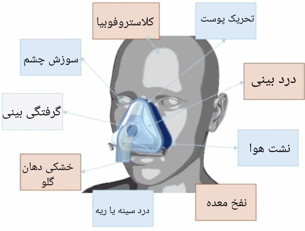 تعمیرات سی پپ در اهواز