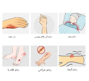 پانسمان آلژینات کلسیم نقره روزین